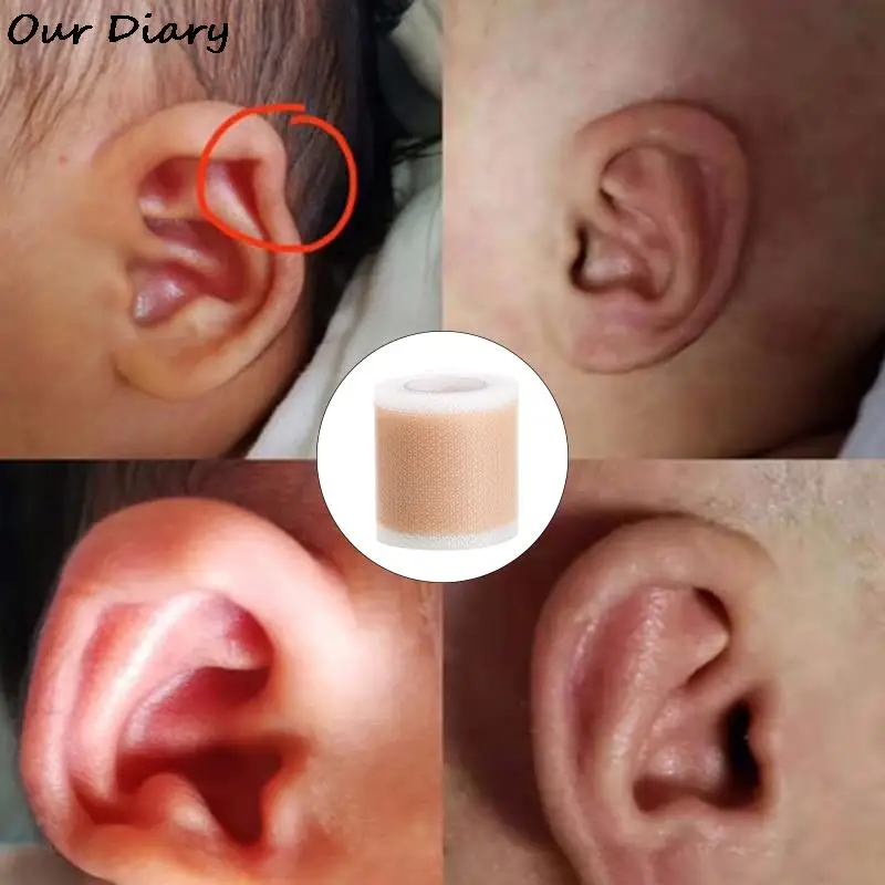 Детские Корректоры для ушей, Медицинская Силиконовая лента, Пластырь для коррекции ушей, Наклейки, Гелевая ткань 4 * 50 см